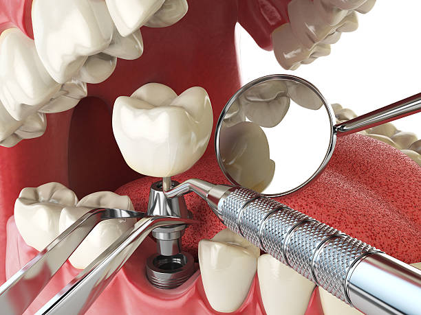 Reliable MI Emergency Dental Service Solutions